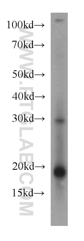 Western Blot (WB) analysis of Jurkat cells using RNF181 Polyclonal antibody (20408-1-AP)