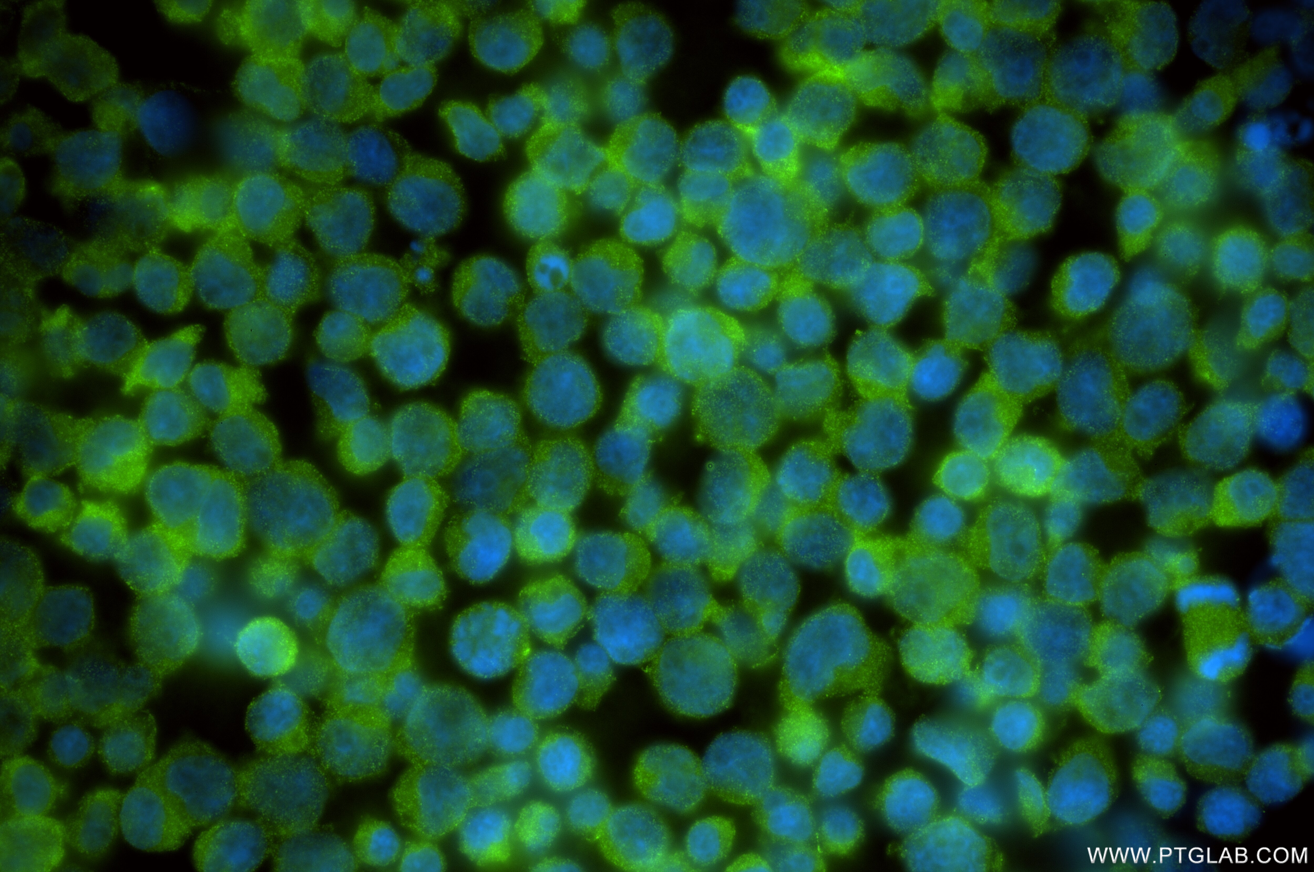 Immunofluorescence (IF) / fluorescent staining of Jurkat cells using RNF181 Recombinant antibody (85735-2-RR)