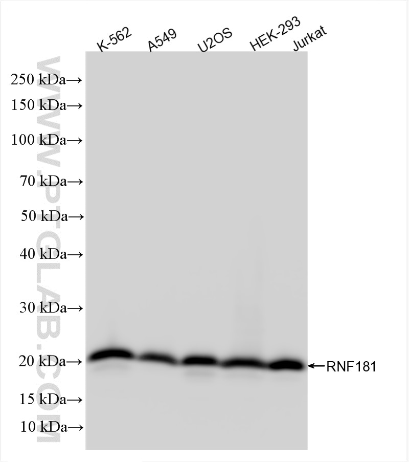 Western Blot (WB) analysis of various lysates using RNF181 Recombinant antibody (85735-2-RR)