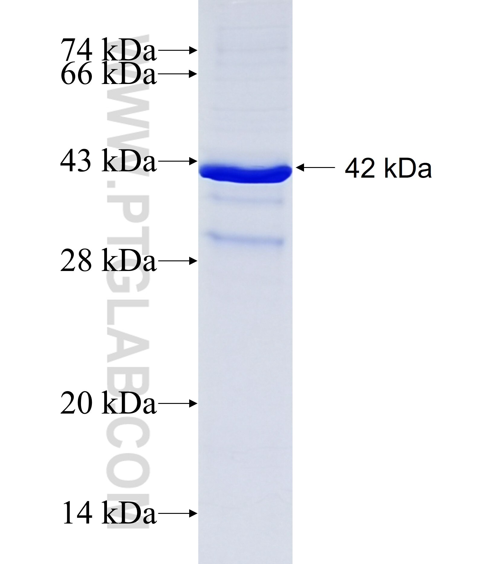 RNF182 fusion protein Ag27390 SDS-PAGE