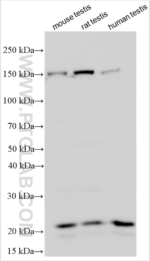 Western Blot (WB) analysis of various lysates using RNF185 Polyclonal antibody (32956-1-AP)