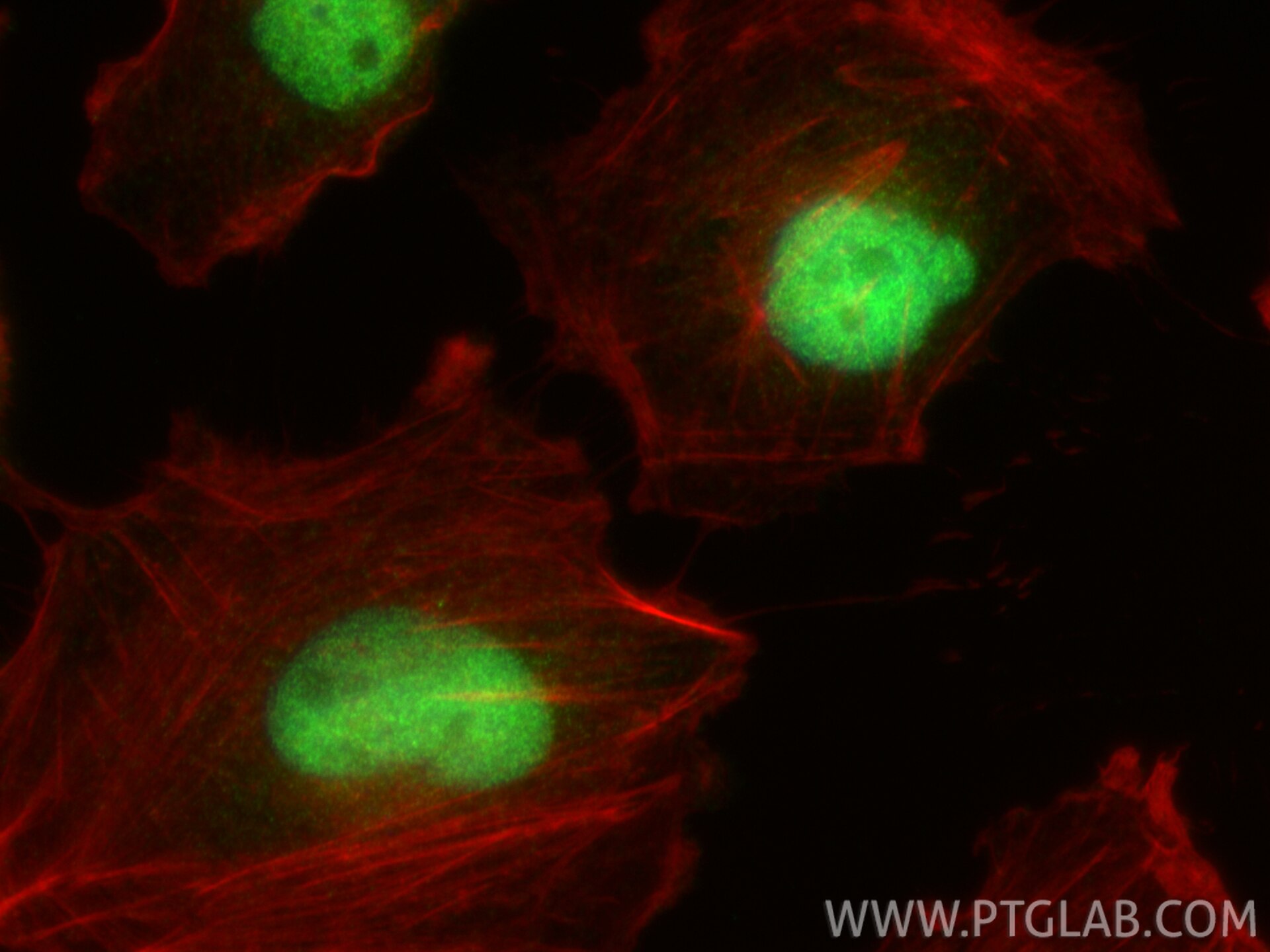 IF Staining of U-251 using 32939-1-AP Immunofluorescence (IF) / fluorescent staining of U-251 cells using RNF187 Polyclonal antibody (32939-1-AP)