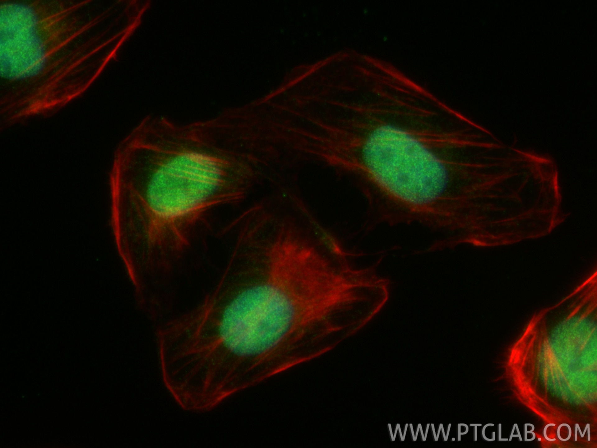 IF Staining of U2OS using 32939-1-AP Immunofluorescence (IF) / fluorescent staining of U2OS cells using RNF187 Polyclonal antibody (32939-1-AP)