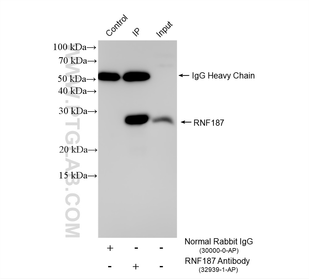 IP experiment of Ramos using 32939-1-AP Immunoprecipitation (IP) experiment of Ramos cells using RNF187 Polyclonal antibody (32939-1-AP)