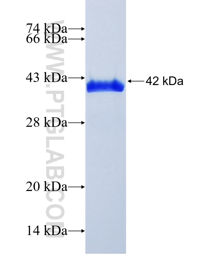 RNF187 fusion protein Ag36665 SDS-PAGE RNF187 fusion protein Ag36665 SDS-PAGE