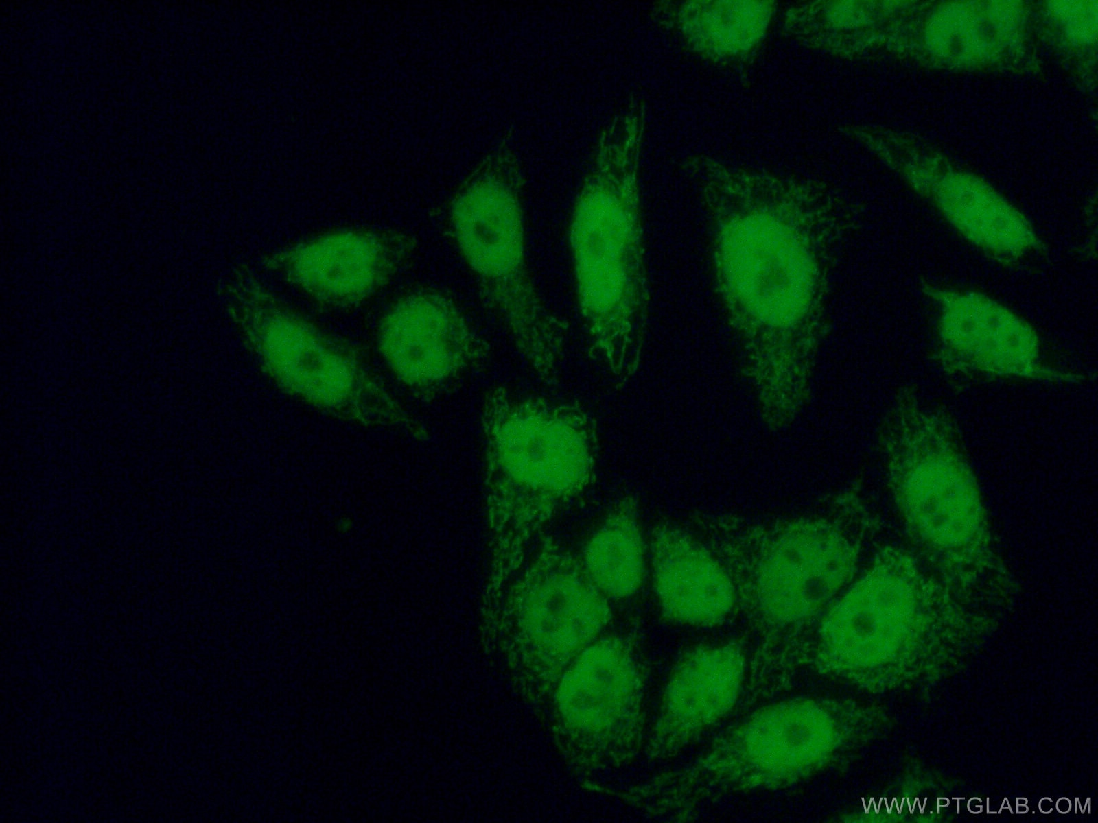 Immunofluorescence (IF) / fluorescent staining of HeLa cells using RNF2 Polyclonal antibody (16031-1-AP)