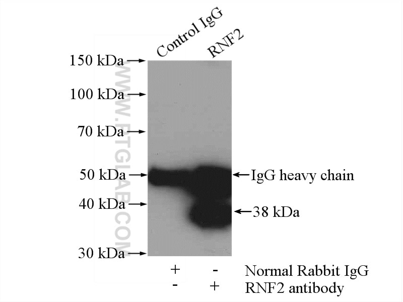 Immunoprecipitation (IP) experiment of K-562 cells using RNF2 Polyclonal antibody (16031-1-AP)
