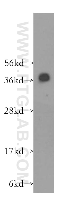 Western Blot (WB) analysis of human brain tissue using RNF2 Polyclonal antibody (16031-1-AP)