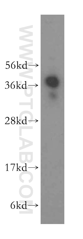 Western Blot (WB) analysis of U-937 cells using RNF2 Polyclonal antibody (16031-1-AP)