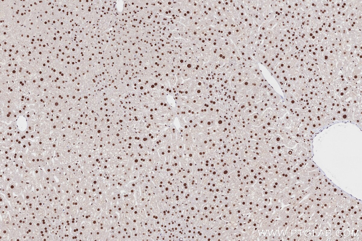 IHC staining of mouse liver using 84793-5-RR Immunohistochemistry (IHC) staining of mouse liver tissue using RNF2 Recombinant monoclonal antibody (84793-5-RR)