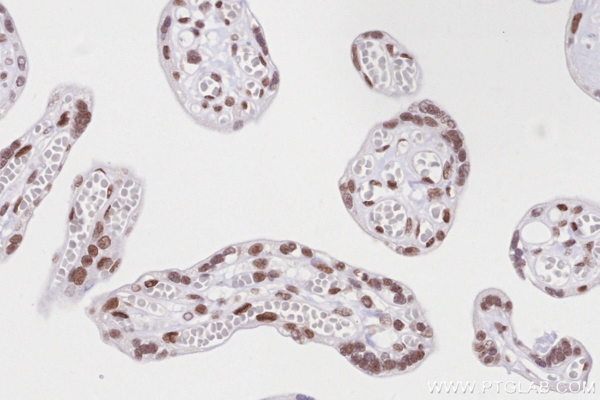 IHC staining of human placenta using 84793-5-RR Immunohistochemistry (IHC) staining of human placenta tissue using RNF2 Recombinant monoclonal antibody (84793-5-RR)