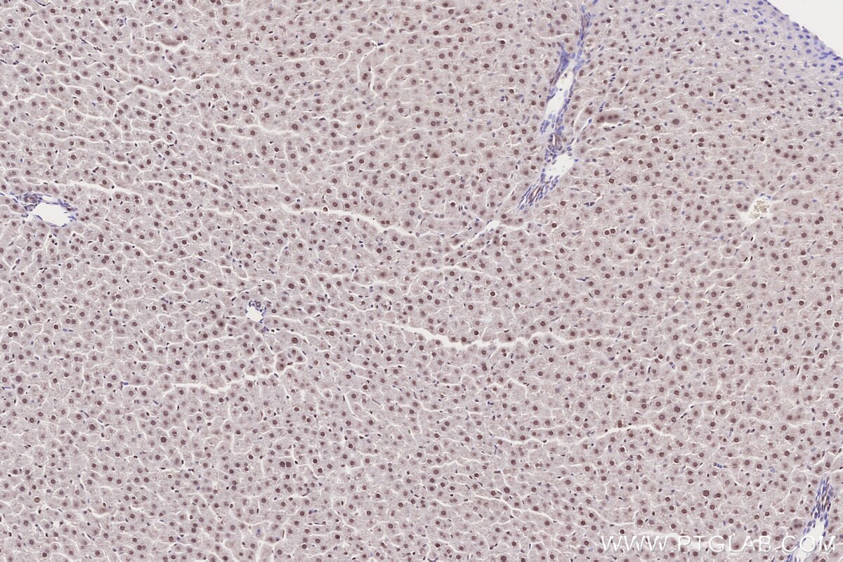 IHC staining of rat liver using 84793-5-RR Immunohistochemistry (IHC) staining of rat liver tissue using RNF2 Recombinant monoclonal antibody (84793-5-RR)