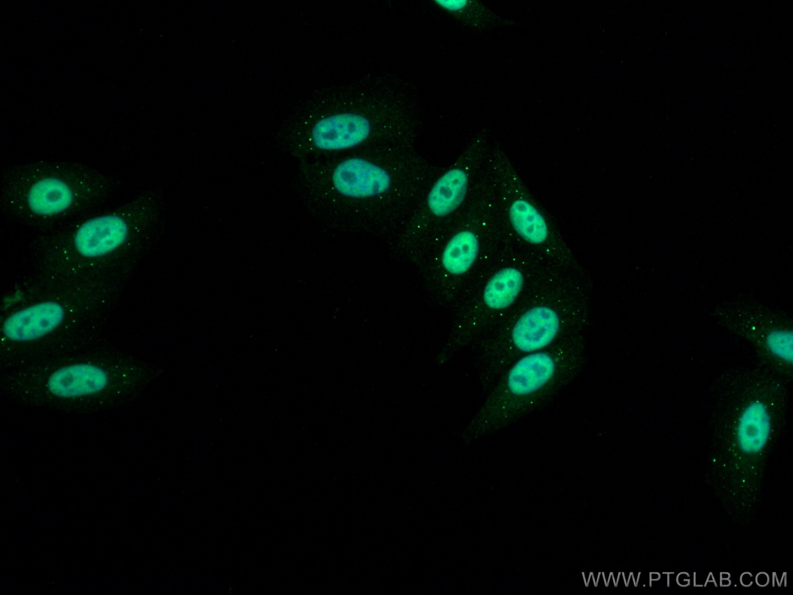 Immunofluorescence (IF) / fluorescent staining of HepG2 cells using RNF20 Polyclonal antibody (21625-1-AP)