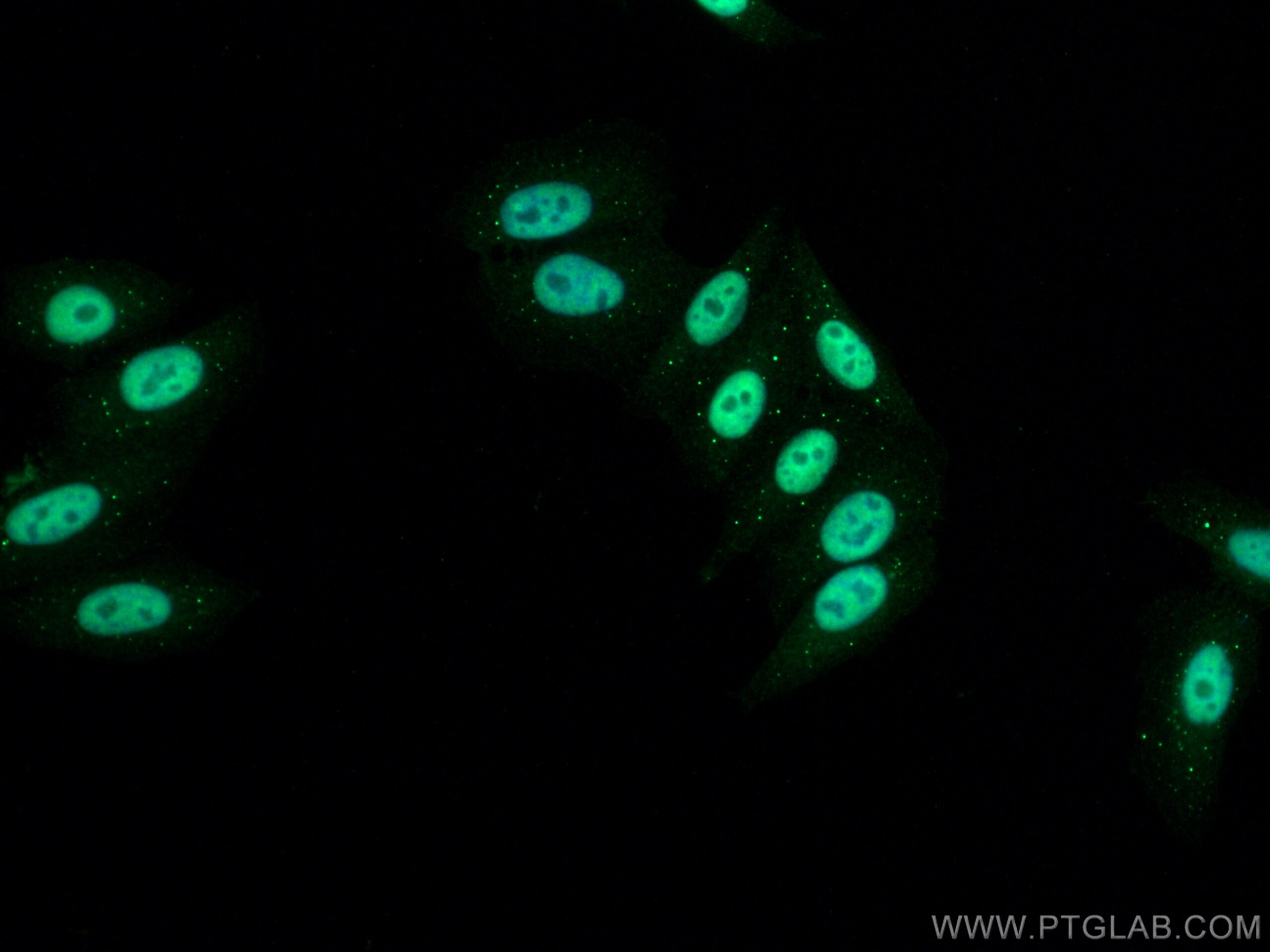 Immunofluorescence (IF) / fluorescent staining of HepG2 cells using RNF20 Polyclonal antibody (21625-1-AP)