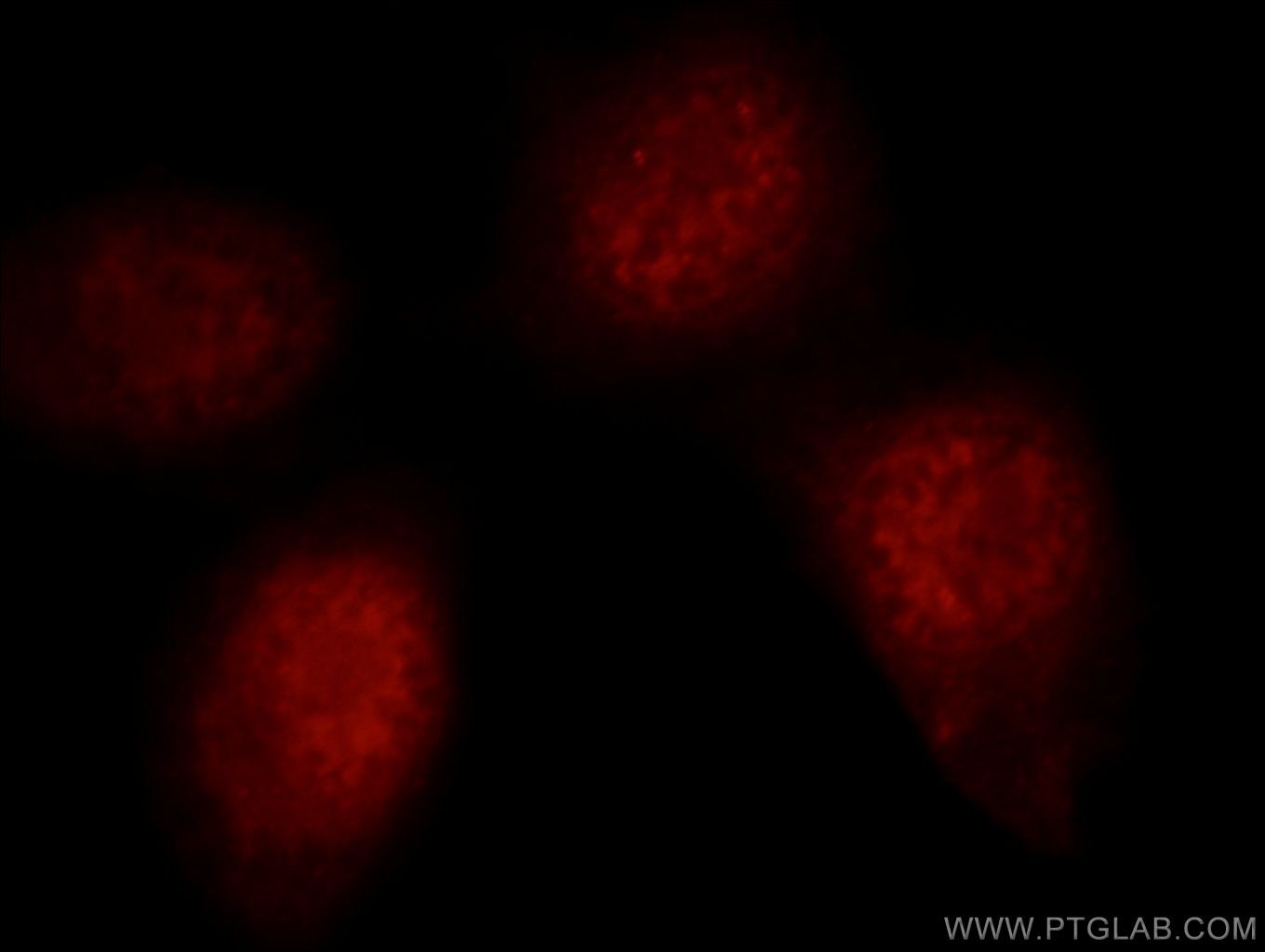 Immunofluorescence (IF) / fluorescent staining of HeLa cells using RNF20 Polyclonal antibody (21625-1-AP)