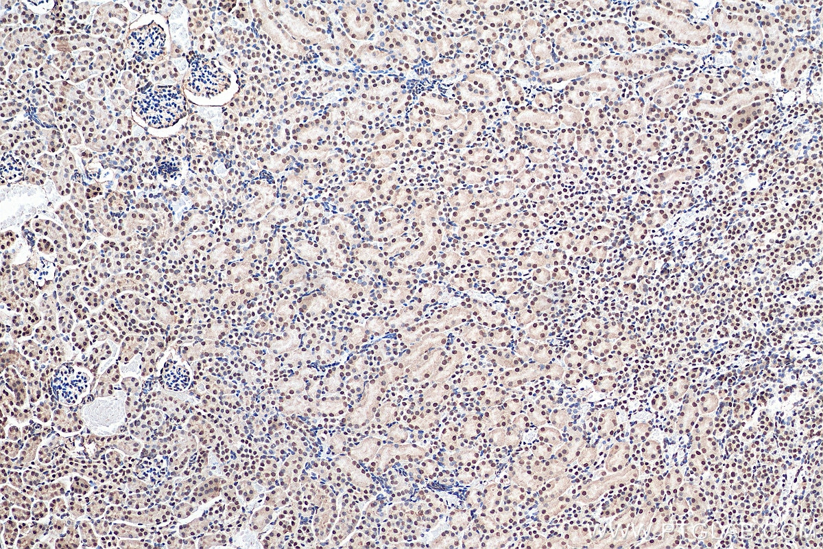 Immunohistochemistry (IHC) staining of mouse kidney tissue using RNF20 Polyclonal antibody (21625-1-AP)