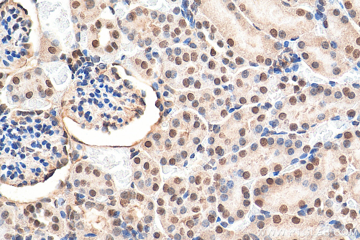 Immunohistochemistry (IHC) staining of mouse kidney tissue using RNF20 Polyclonal antibody (21625-1-AP)