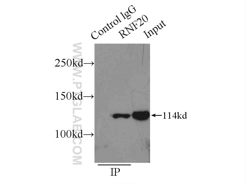 Immunoprecipitation (IP) experiment of HeLa cells using RNF20 Polyclonal antibody (21625-1-AP)