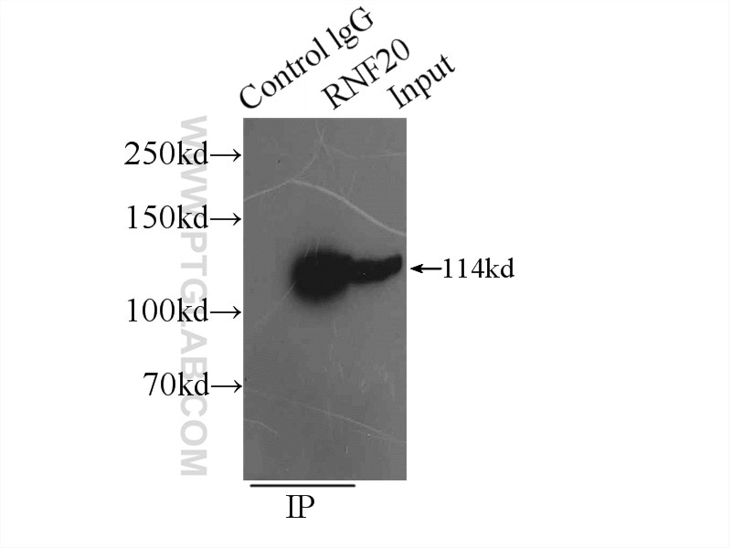 Immunoprecipitation (IP) experiment of HeLa cells using RNF20 Polyclonal antibody (21625-1-AP)