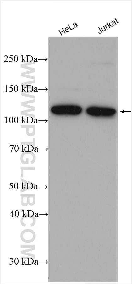 Western Blot (WB) analysis of various lysates using RNF20 Polyclonal antibody (21625-1-AP)
