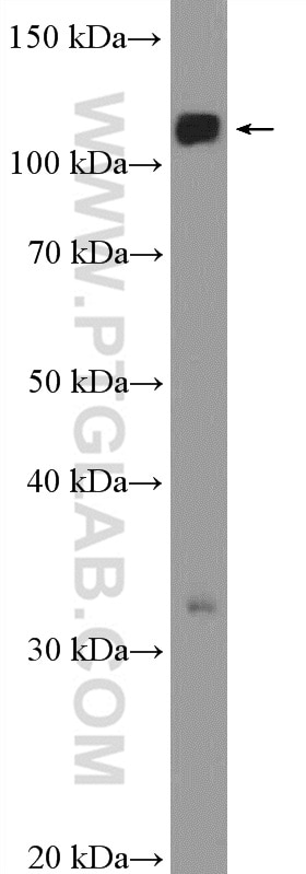 WB analysis of mouse liver using 21625-1-AP