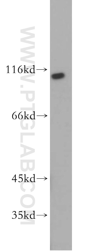 Western Blot (WB) analysis of MCF-7 cells using RNF20 Polyclonal antibody (21625-1-AP)