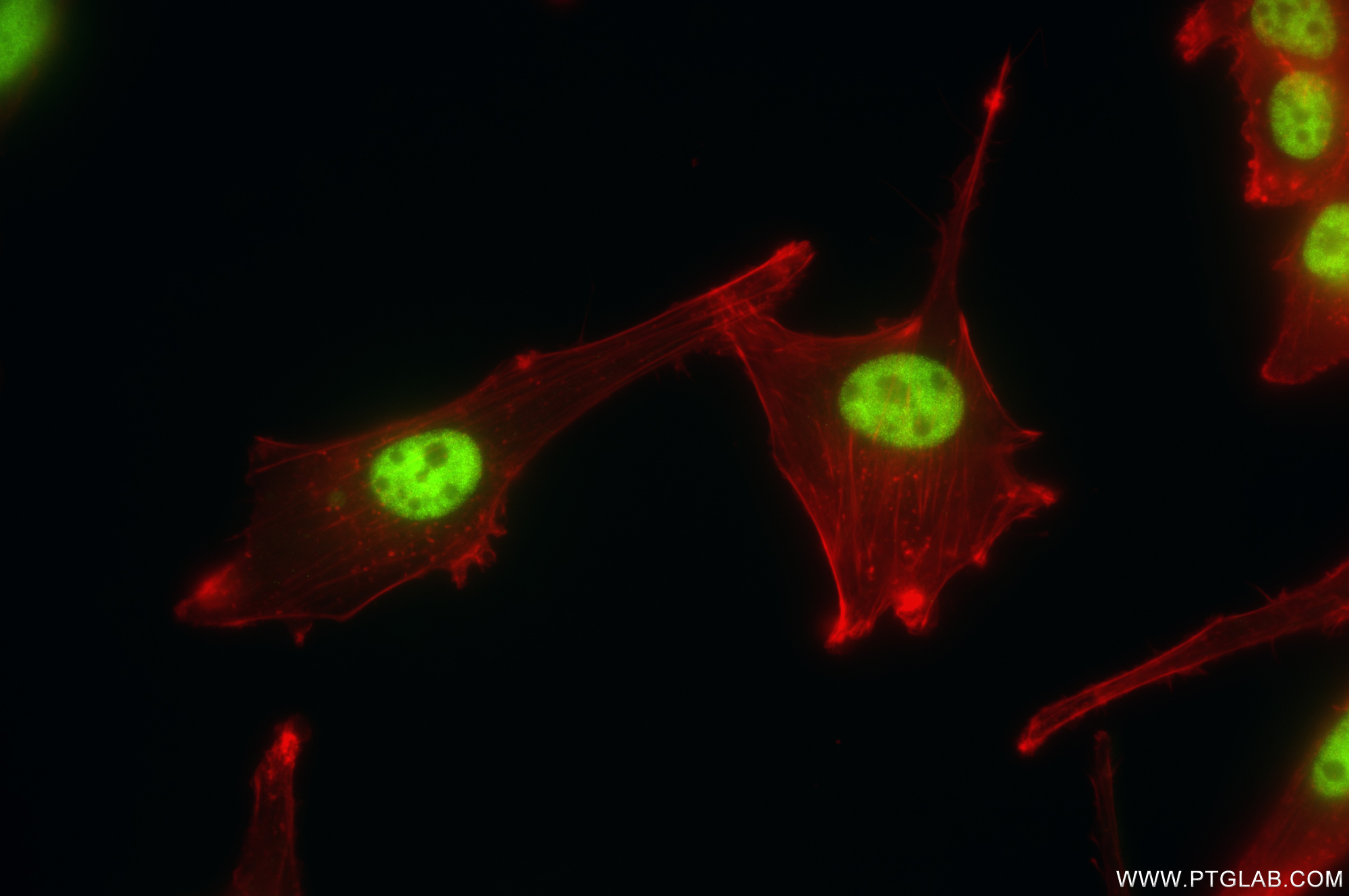 Immunofluorescence (IF) / fluorescent staining of U-87 MG cells using RNF20 Recombinant antibody (85630-6-RR)