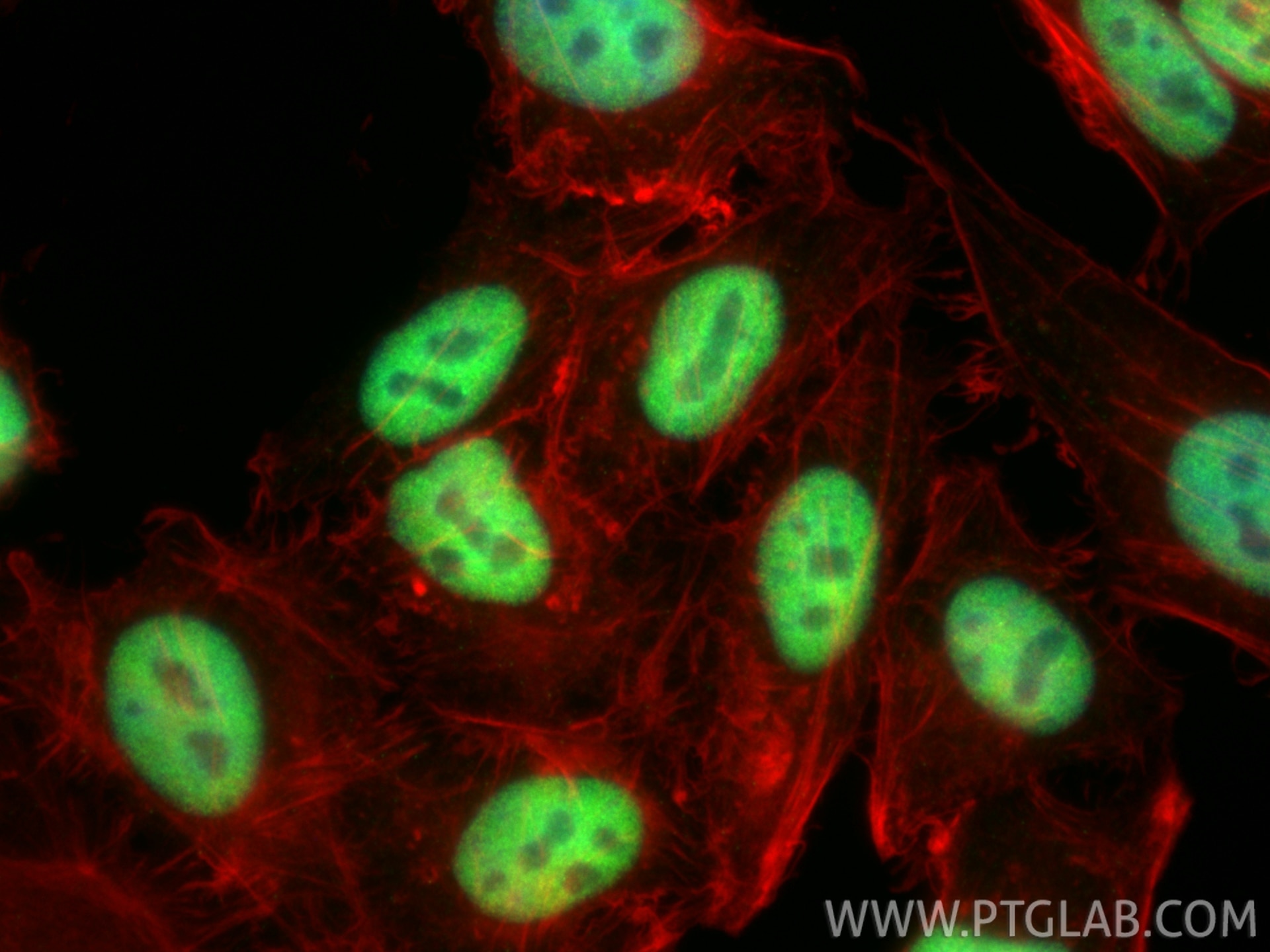 Immunofluorescent analysis of (4% PFA) fixed HepG2 cells using RNF20 antibody (85630-6-RR, Clone: 243078G12 ) at dilution of 1:200 and CoraLite®488-Conjugated Goat Anti-Rabbit IgG(H+L) (SA00013-2), CL594-phalloidin (red). Immunofluorescence (IF) / fluorescent staining of HepG2 cells using RNF20 Recombinant monoclonal antibody (85630-6-RR)