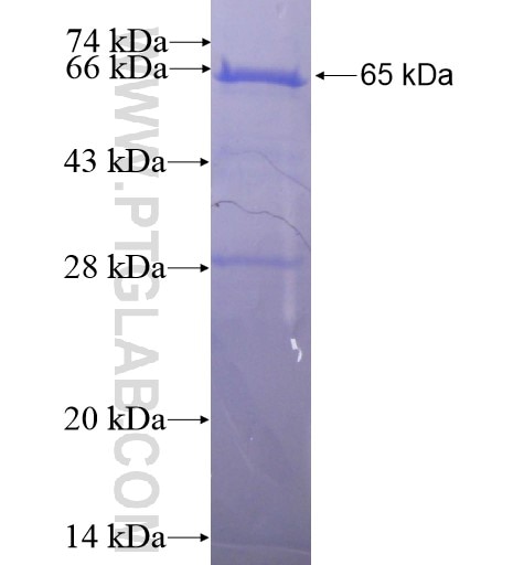 RNF20 fusion protein Ag16066 SDS-PAGE