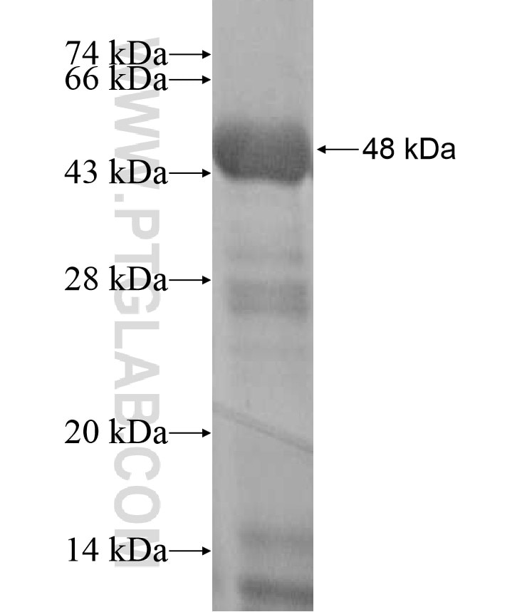 RNF20 fusion protein Ag17355 SDS-PAGE
