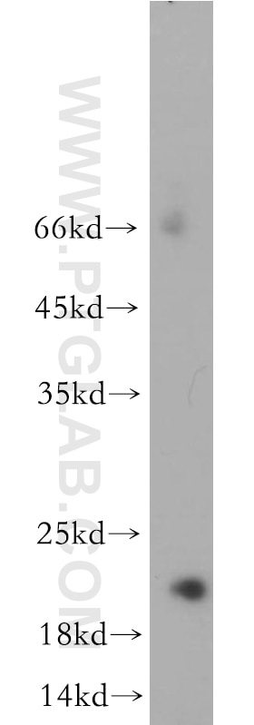 Western Blot (WB) analysis of human heart tissue using RNF212 Polyclonal antibody (21178-1-AP)