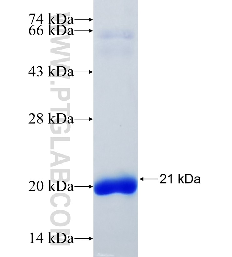 RNF212 fusion protein Ag31804 SDS-PAGE RNF212 fusion protein Ag31804 SDS-PAGE