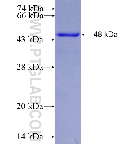 RNF212 fusion protein Ag15457 SDS-PAGE