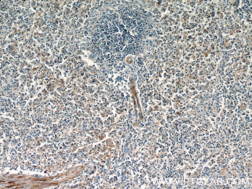 IHC staining of human spleen using 21028-1-AP