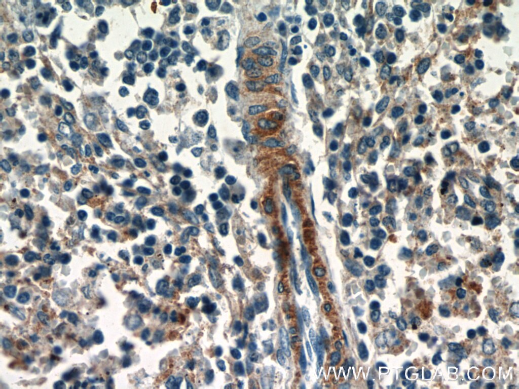 Immunohistochemistry (IHC) staining of human spleen tissue using RNF213 Polyclonal antibody (21028-1-AP)