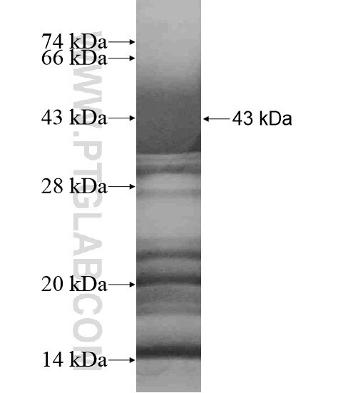 RNF215 fusion protein Ag18750 SDS-PAGE