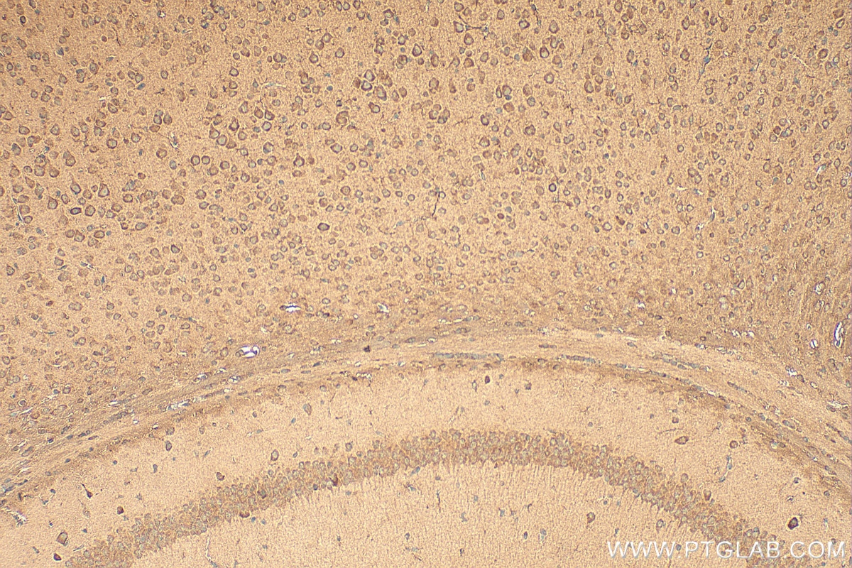 Immunohistochemical analysis of paraffin-embedded mouse brain tissue slide using 10185-1-AP (RNF216 antibody) at dilution of 1:200 (under 10x lens). Heat mediated antigen retrieval with Tris-EDTA buffer (pH 9.0). Immunohistochemistry (IHC) staining of mouse brain tissue using RNF216 Polyclonal antibody (10185-1-AP)