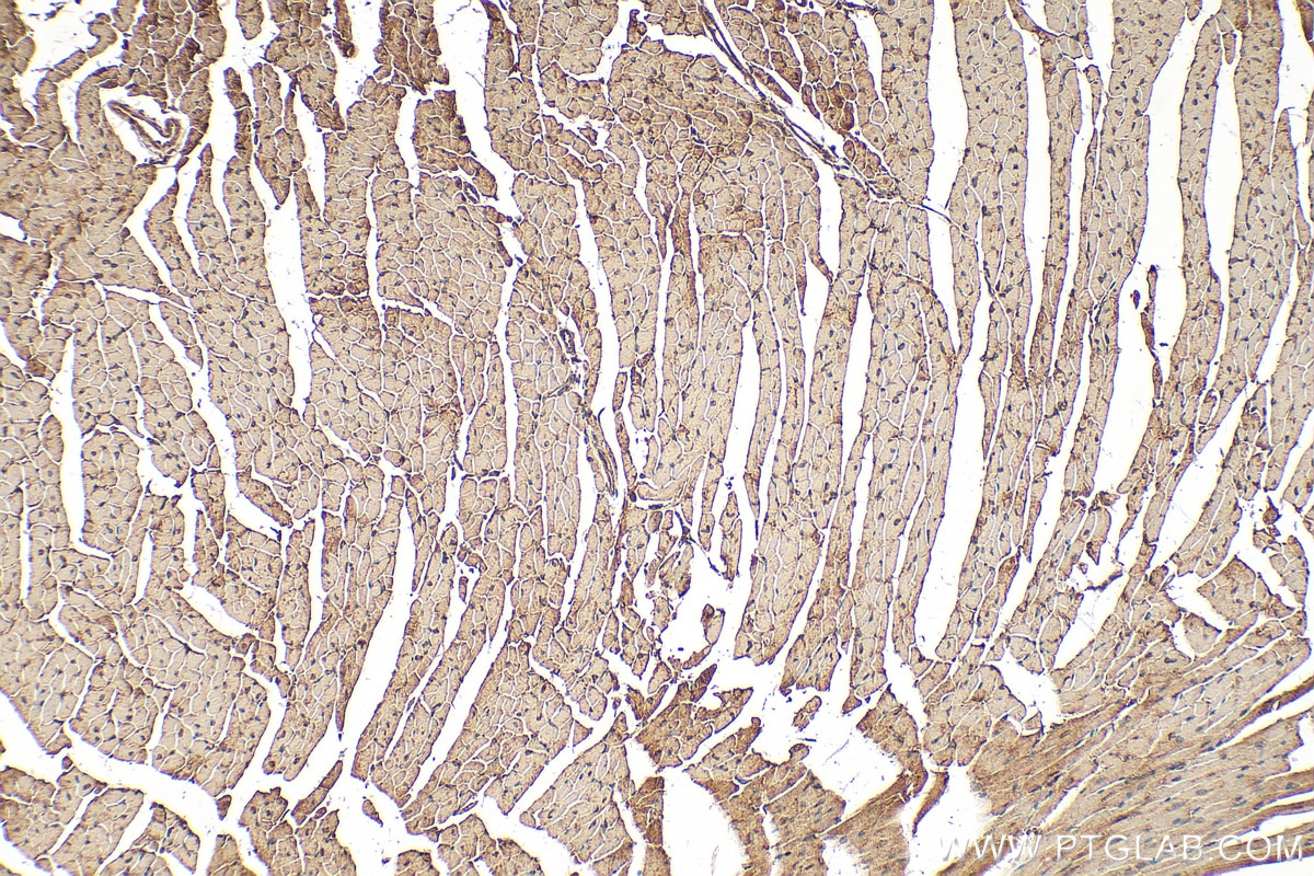 Immunohistochemical analysis of paraffin-embedded mouse heart tissue slide using 10185-1-AP (RNF216 antibody) at dilution of 1:200 (under 10x lens). Heat mediated antigen retrieval with Tris-EDTA buffer (pH 9.0). Immunohistochemistry (IHC) staining of mouse heart tissue using RNF216 Polyclonal antibody (10185-1-AP)