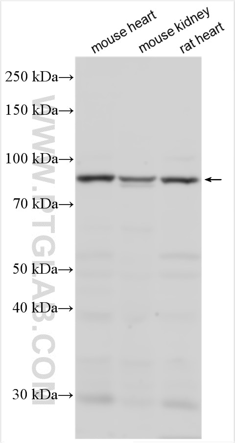 Western Blot (WB) analysis of various lysates using RNF216 Polyclonal antibody (10185-1-AP)