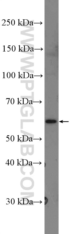 Western Blot (WB) analysis of U2OS cells using RNF216 Polyclonal antibody (10185-1-AP)