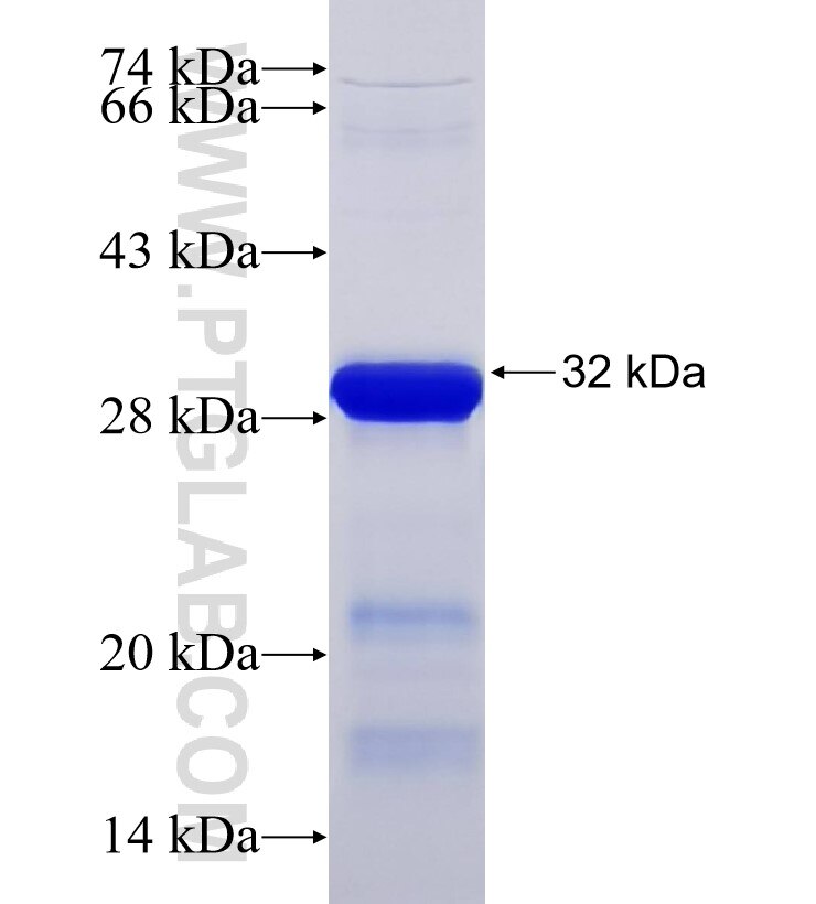 RNF216 fusion protein Ag33828 SDS-PAGE RNF216 fusion protein Ag33828 SDS-PAGE