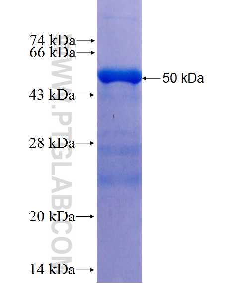 RNF216 fusion protein Ag0238 SDS-PAGE