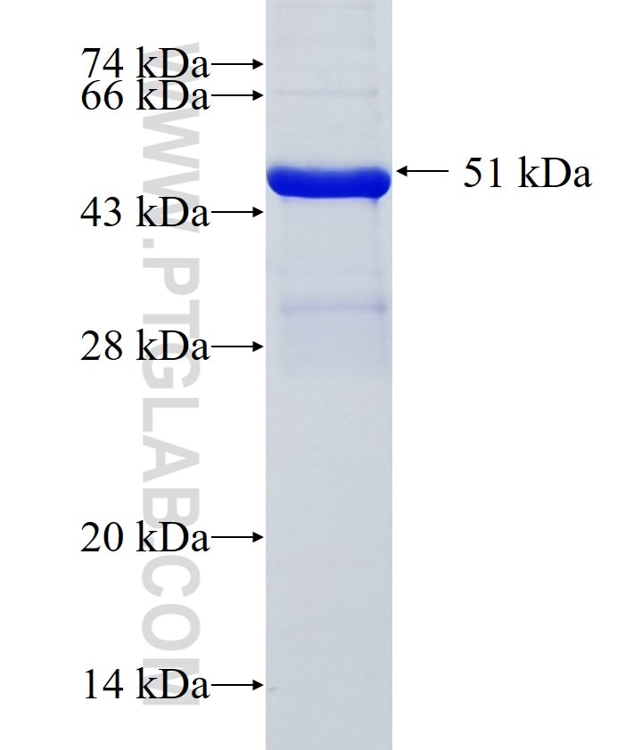 RNF216 fusion protein Ag0238 SDS-PAGE