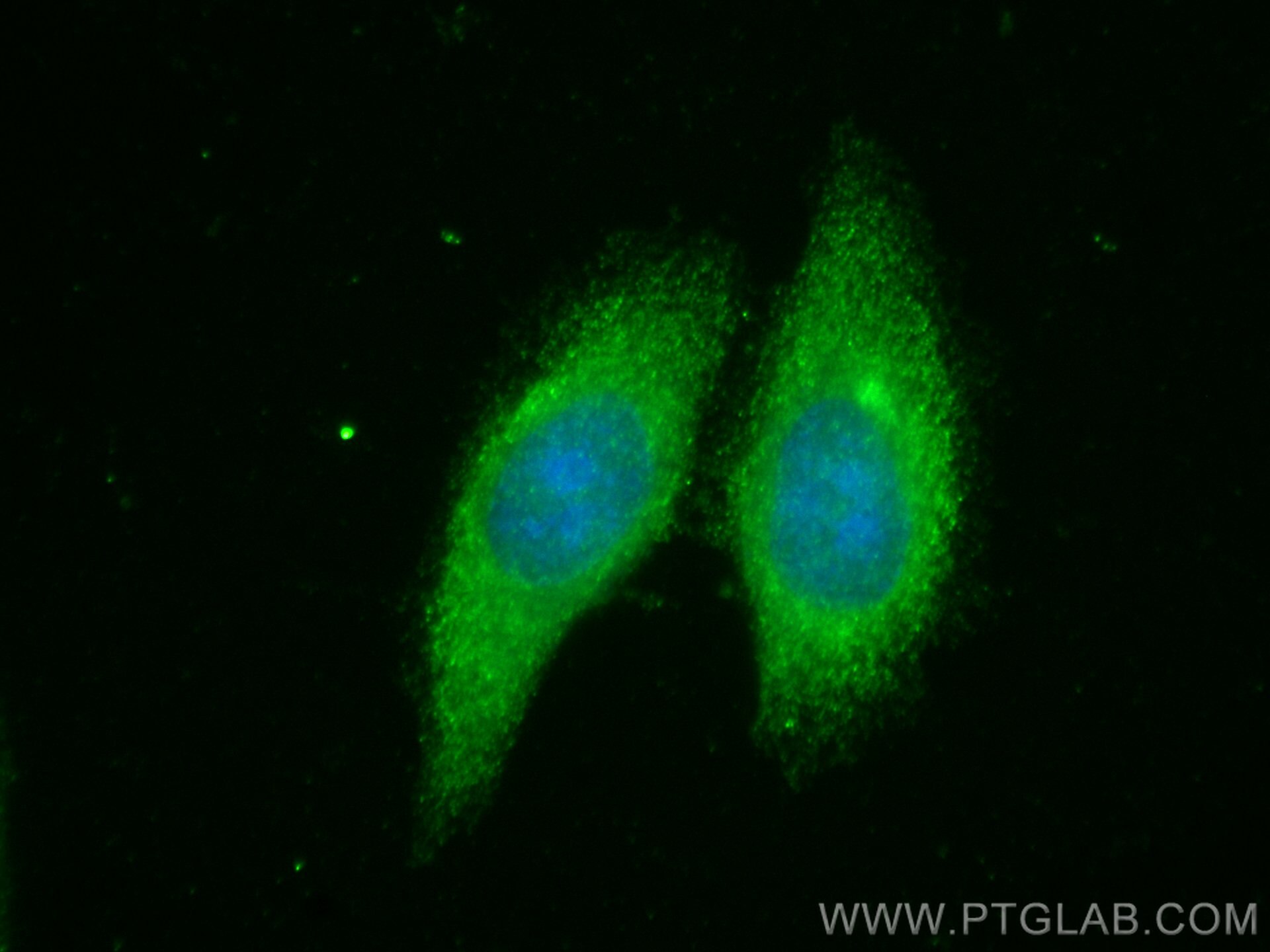 Immunofluorescence (IF) / fluorescent staining of HepG2 cells using RNF217 Polyclonal antibody (26084-1-AP)