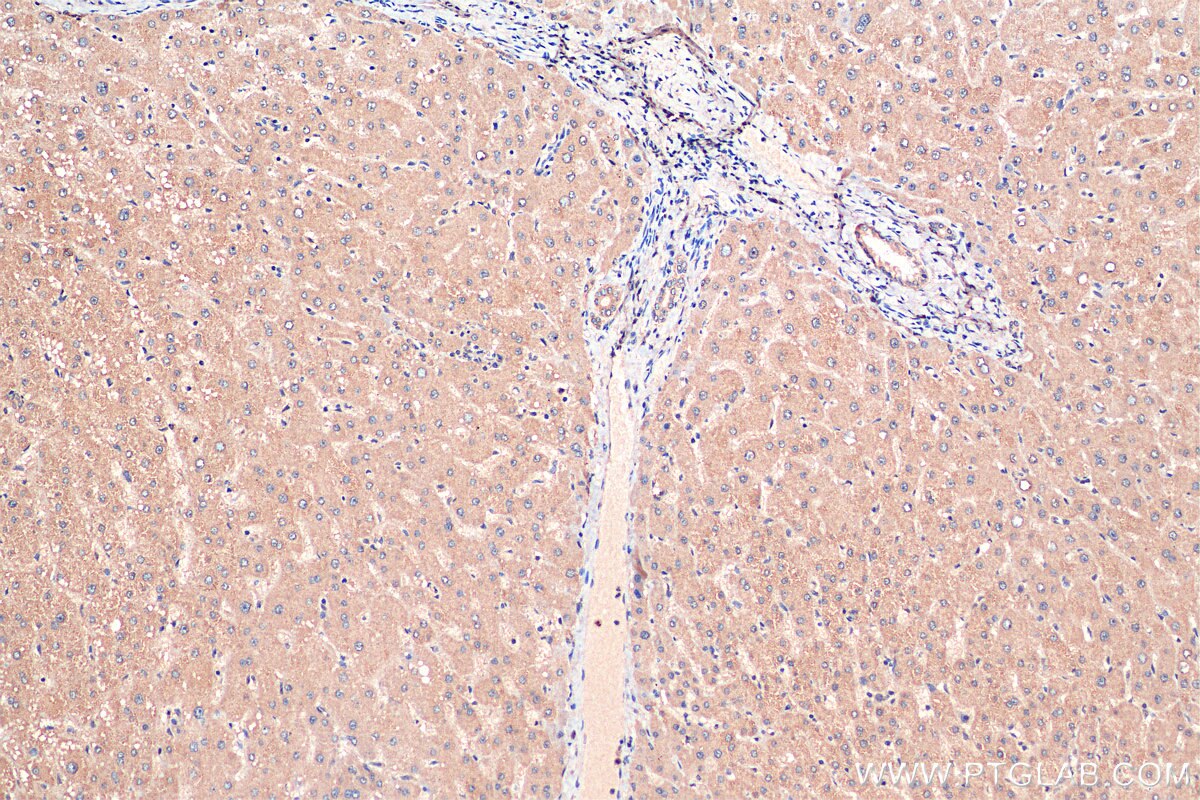 Immunohistochemistry (IHC) staining of human liver tissue using RNF217 Polyclonal antibody (26084-1-AP)