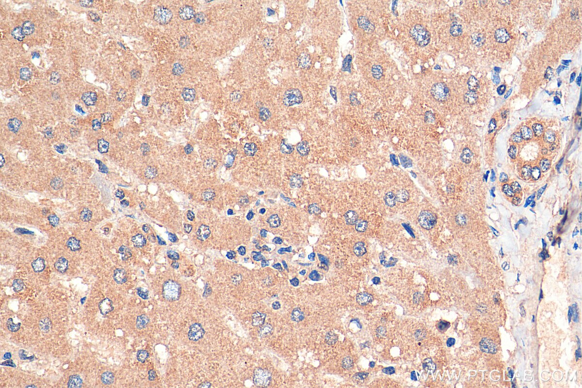 Immunohistochemistry (IHC) staining of human liver tissue using RNF217 Polyclonal antibody (26084-1-AP)