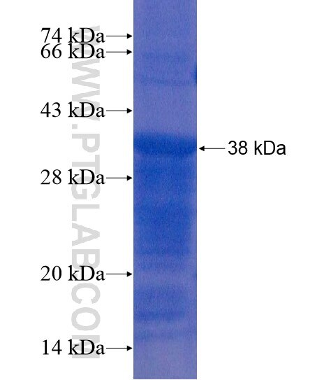 RNF217 fusion protein Ag22022 SDS-PAGE