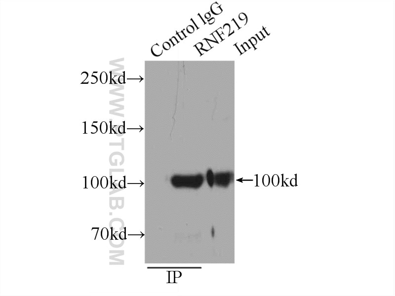 Immunoprecipitation (IP) experiment of HEK-293 cells using RNF219 Polyclonal antibody (24988-1-AP)