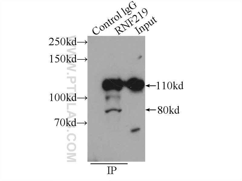 Immunoprecipitation (IP) experiment of A431 cells using RNF219 Polyclonal antibody (24988-1-AP)