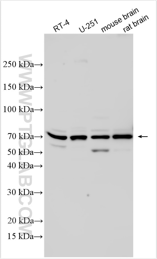 Western Blot (WB) analysis of various lysates using RNF220 Polyclonal antibody (32482-1-AP)